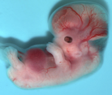 A baby at 7 store weeks old in the womb